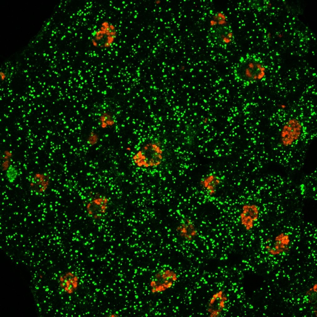 Same insulin flooded with green GLUT-4 protein after oleocanthol